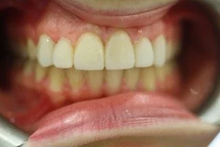 Dental Treatment After 2