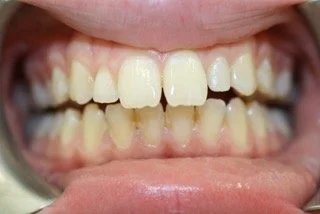 Dental Treatment Before 2
