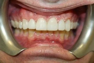 Dental Treatment After 3