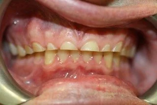 Dental Treatment Before 3