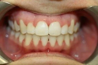 Dental Treatment After 1