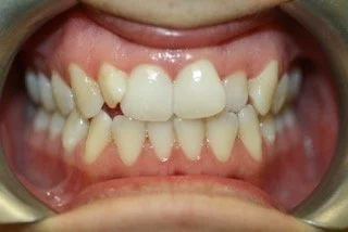 Dental Treatment Before 1