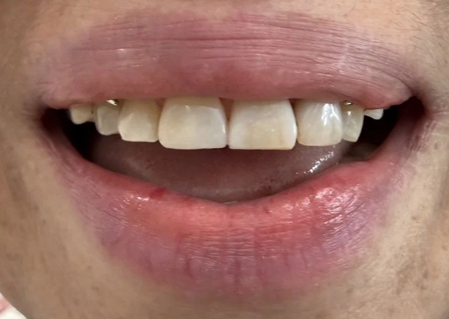 Dental Treatment After 5